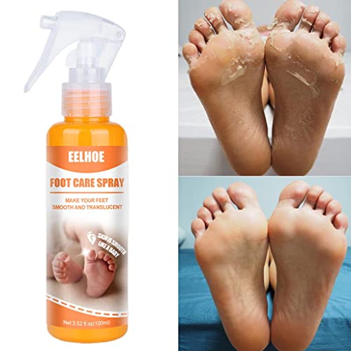 SM SunniMix Spray para pelar los pies, spray hidratante para el cuidado de los pies, cuidado corporal hidratante, exfoliante natural para manos, piel muerta, 100 ml