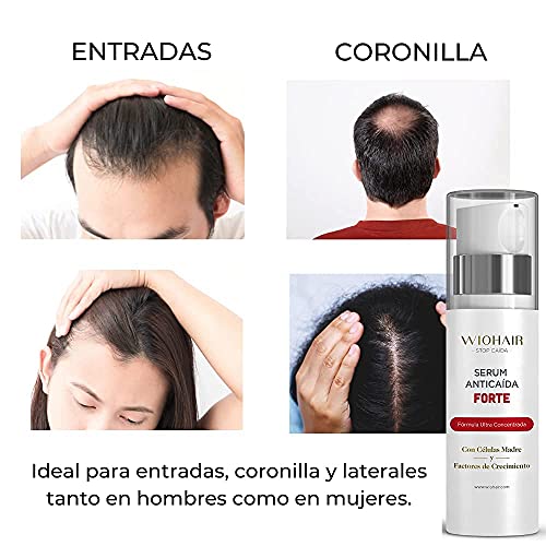 Wiohair Serum Anticaída Pelo Premium | Para entradas, zonas débiles, claros y coronilla | Frena la Caída avanzada y regenera el cabello | Sin sulfatos, Siliconas y Parabenos | Para Hombres y Mujeres