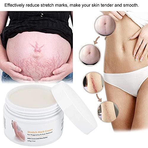 120g Crema Antiestrias Embarazo, Crema para las estrías, Eliminar las estrías, Eliminar Cicatrices del Embarazo, Reparar cicatriz Línea floja Abdomen Estrías para posparto