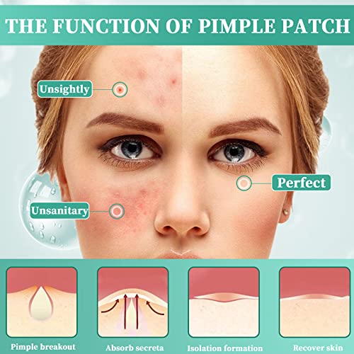 216 PCS Parches Acne con Agujas, Máscaras Hidrocoloides Invisibles de 8/12 mm Que Suavizan Eficazmente la Reparación de La Piel Del Acné/Absorción de Secreciones (Hombres/Mujeres)