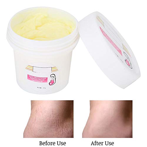35g Crema de eliminación de estrías Cicatrices de embarazo Crema reparadora calmante para la piel Cuidado y reparación posparto