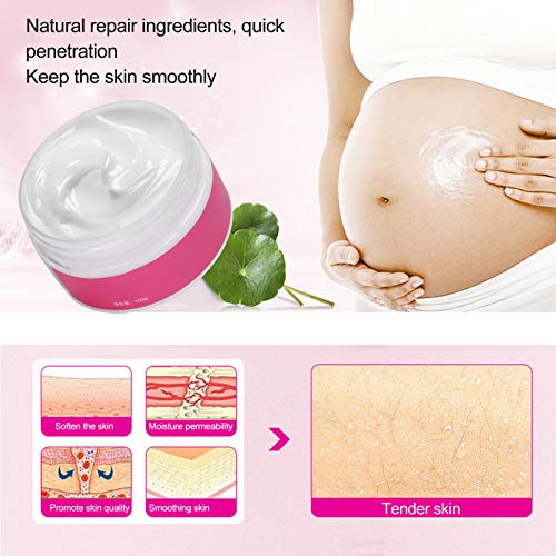 Crema reparadora de estrías 2pcs - Desvanecer las cicatrices del embarazo Quitar las estrías Líneas de obesidad Mujeres embarazadas Reparación posparto Crema reafirmante para reafirmar la piel