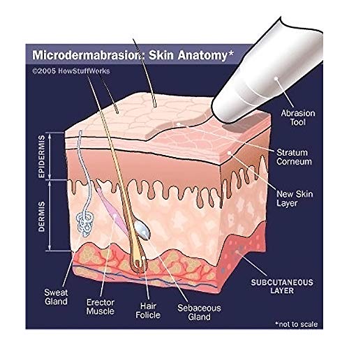 Cristales de microdermabrasión (1.81 kg, 120 Grano) Tratamiento exfoliante facial rejuvenecedor de piel completamente natural para piel opaca o seca, cicatrices del acné y más por NeedCrystals