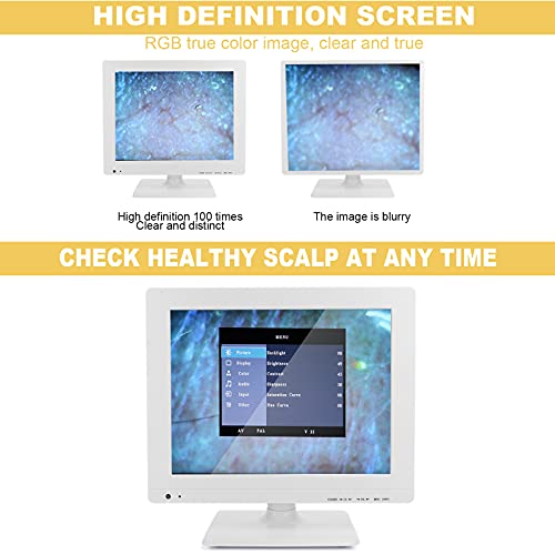 Detector de cuero cabelludo Analizador de piel capilar, Máquina analizadora de folículos capilares de cuero cabelludo de alta definición de 15'' 100X Detección digital de la salud de la piel(EU)