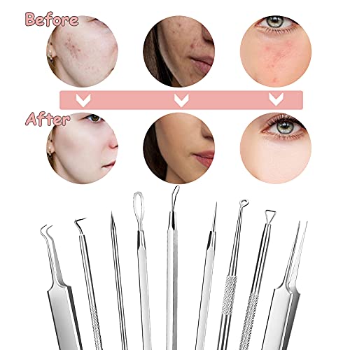 GeekerChip 9 Piezas de Herramientas para Eliminar Espinillas,Blackhead Remover Aguja de Acné para Quita Espinillas Granos Comedones