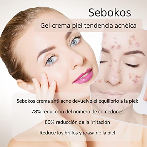 Kosei - Sebokos Gel/Crema para Pieles con Acné - 50 ml - Tratamiento para el Acné - Ideal para Pieles Grasas - Reduce Brillos, Puntos Negros y Rojeces - Sin Aceites - Unisex - Vegano