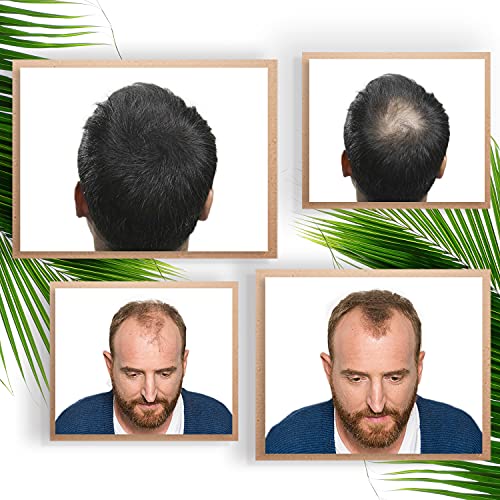VidalForce, | Fibras capilares 100% de origen Vegetal | Polvos pelo hombre y mujer - Fibra capilar Castaño Oscuro (30gr)