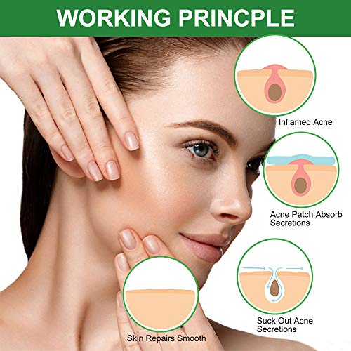 Acne Pimple Patch, Parches de Acné, Pegatinas de Acné, Invisibles Hidrocoloides Absorbentes Parches Para Acné, Tratamientos de Acné, Espinilla y Manchas