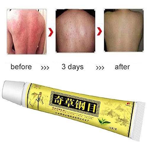 Crema de Hierbas Chinas Naturales, Crema de Medicina China, Crema Anti-picazón, Solo para Uso Externo, Dermatitis, inflamación y erupciones (5 Piezas)