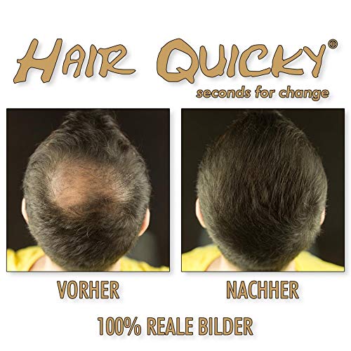 Hair Quicky® Premium Hair Fibers, fibras de pelo, construcción de pelo espesante de cabello, en caso de alopecia calvicie caída del pelo o cabello ralo, natural queratina |100g | negro