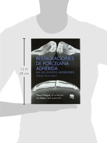 RESTAURACIONES DE PORCELANA ADHERIDA EN LOS DIENTES ANTERIORES, METODO BIOMIMETICO (LIBRO CON ESTUCH