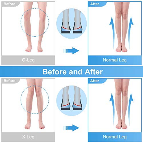 DOACT Plantilla ortopédica corrección piernas en forma 2 pares, elevación cuña del talón para piernas tipo O/X, almohadilla de gel silicona para la corrección la pierna, supinación y pronación L