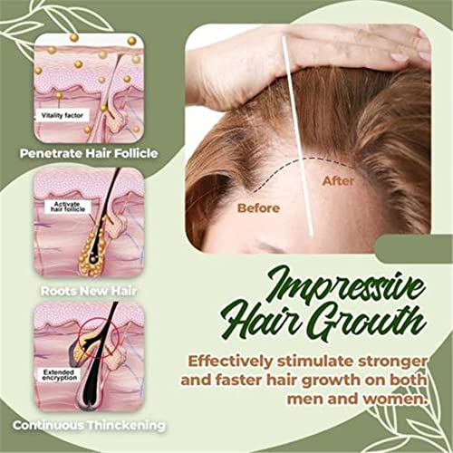 Herbalrevive Hair-growth Essence Spray, Hairrebirth Herbal Spray, Herbal Hair-growth Essence Spray, Hair Volumizer Texture Spray, Send Massage Comb (3pcs)