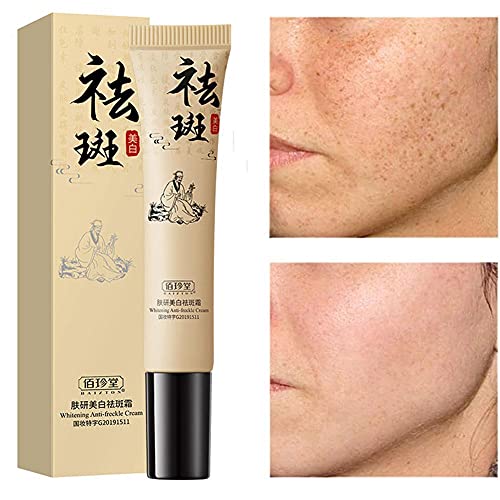 XUEJIAN Crema blanqueadora para blanquear la Cara, Eliminar el Melasma, Pigmento de Manchas de acné, Crema hidratante para Manchas oscuras de melanina, Cuidado de la Piel