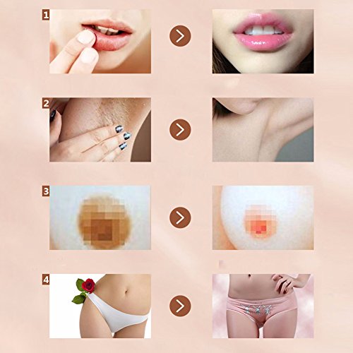 Crema blanqueadora íntima 30ml Crema para aclarar la piel femenina Axilas Labios Areola Labios Blanqueamiento de pezones Cuidado del cuerpo Piel natural Belleza Belleza Blanqueamiento Hidratante Blanq