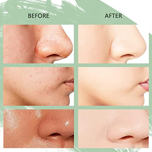 Green Mask Stick Anti-acné, 100% Extracto de té Verde y Varios Extractos de Plantas, Blanquea y Elimina Puntos Negros Green Tea Cleansing Mask, Absorbe Aceite de Poros y Suciedad Mascarillas Faciales