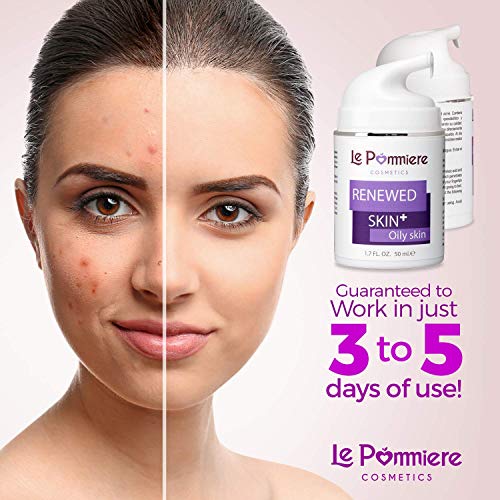 Le Pommiere Tratamiento Acné gel 50ml. Ayuda a remover espinillas, granos en cara o cuerpo. Anti imperfecciones facial y corporal. Adolescente, juvenil, hormonal o quístico