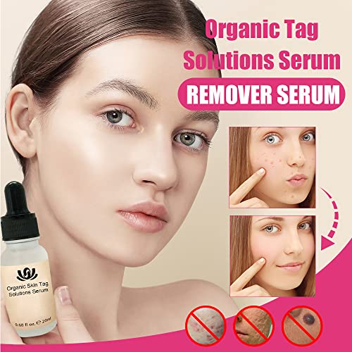 CVFR Organic Skin Tag Solutions Serum, Mole Corrector Skin Tag Remover, Organic Skin Spot Purifying Serum, All Natural Tags Free Mole & Tag Removal (2PCS)