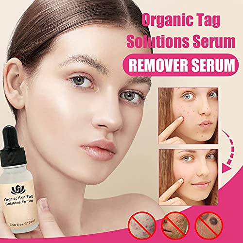 fghj 3pcs Organic Skin Spot Purifying Serum, Skin Tags Solutions Serum, Dark Spot Corrector Mole Remover, All Natural Purifying Serum Fix Black Spot,Safe,Effective