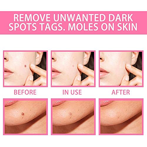 fghj 3pcs Organic Skin Spot Purifying Serum, Skin Tags Solutions Serum, Dark Spot Corrector Mole Remover, All Natural Purifying Serum Fix Black Spot,Safe,Effective