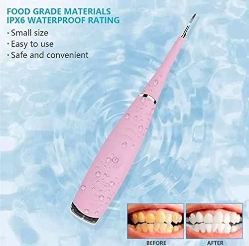 Limpiador de Sarro Limpieza Dental y Bucal, Cepillo Dientes Cuidado Profesional , Blanqueamiento Kit Dental, Carga USB Color Rosa