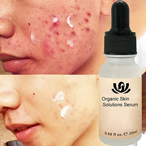 LXLX Organic Skin Spot Purifying serum Mole Remover, Dark Spot Corrector Brightening Serum, Mole Corrector Skin Tag Remover, Organic Tags Solutions Serum