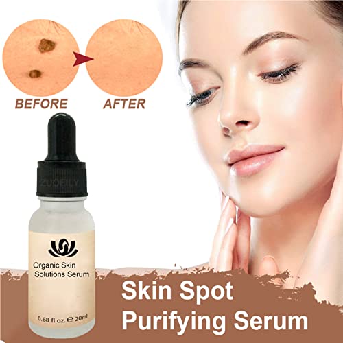 LXLX Organic Skin Spot Purifying serum Mole Remover, Dark Spot Corrector Brightening Serum, Mole Corrector Skin Tag Remover, Organic Tags Solutions Serum