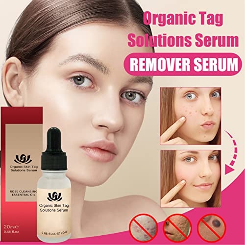 LXLX Organic Skin Tag Solutions Serum, Mole Corrector Skin Tag Remover, Organic Tags Solutions Serum, Anti Aging Serum & Dark Spot Corrector for Face - Natural Plant Formula (2PCS)