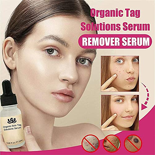 MTDBAOD Organic Tags Solutions Serum,Pure Natural Mole and Skin Tag Remover,Dark Spot Corrector Brightening Serum,Repair Cream Oil,for Spot Remover,Wart and Tag Removal (2PCS)