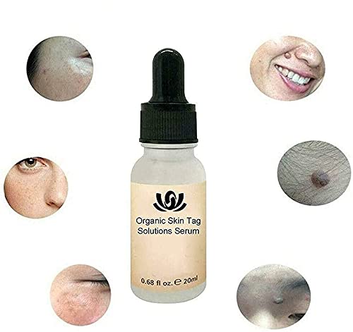 MTDBAOD Organic Tags Solutions Serum,Pure Natural Mole and Skin Tag Remover,Dark Spot Corrector Brightening Serum,Repair Cream Oil,for Spot Remover,Wart and Tag Removal (2PCS)