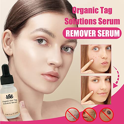 Organic Tags Solutions Serum, Mole and Skin Tag Remover and Repair Cream Oil,Organic Skin Spot Purifying Serum Tags Free Mole & Tag Removal New-All Natural (5PCS)