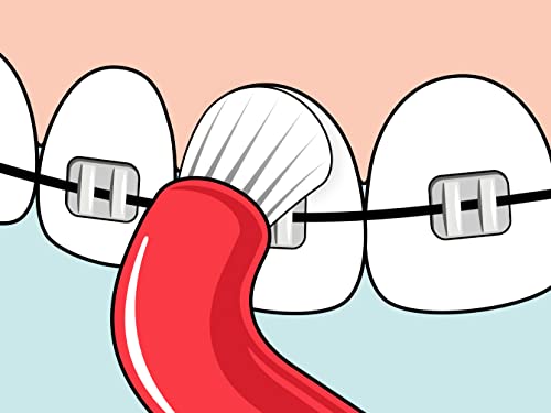 TePe Compact Tuft - Cepillo de dientes en ángulo especial, cepillo pequeño de una cabeza, para áreas difíciles, aparatos de ortodoncia e implantes, colores aleatorios