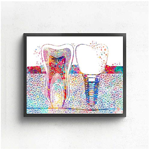 ZMFBHFBH Cuadro en Lienzo Arte Dental Imagen Implante Dental Dentista Arte de la Pared Pintura Medicina Higienista Cartel Clínica Dental Decoración 20x30cm (7.8"x11.8) Sin Marco