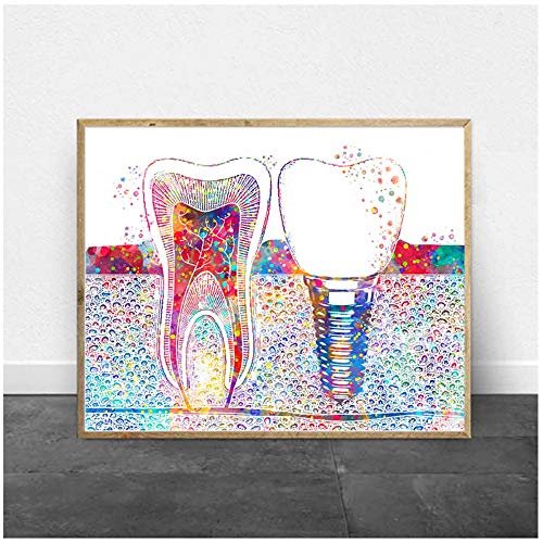 ZMFBHFBH Cuadro en Lienzo Arte Dental Imagen Implante Dental Dentista Arte de la Pared Pintura Medicina Higienista Cartel Clínica Dental Decoración 20x30cm (7.8"x11.8) Sin Marco