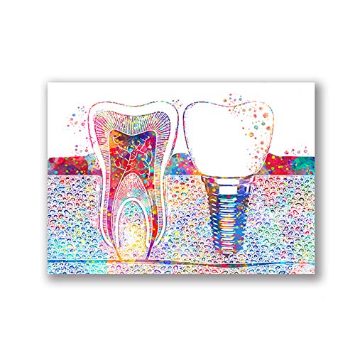 ZMFBHFBH Cuadro en Lienzo Arte Dental Imagen Implante Dental Dentista Arte de la Pared Pintura Medicina Higienista Cartel Clínica Dental Decoración 20x30cm (7.8"x11.8) Sin Marco