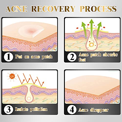 252 Pcs Parches Para Acné, Uso Diurno y Nocturno, Parches Hidrocoloides Para el Acné 2 en 1Parches Maestros de Espinillas Hidrocoloides Invisibles Ultrafinos