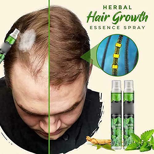 Herbal Hair Growth Essence Spray - Anti Hair Loss Fast Grow Prevent Hair Dry,Natural Herbal Rapid Hair Growth Serum,Prevent Postpartum Hair Loss Hairlines Herbal Hair Essence Spray (5pcs)