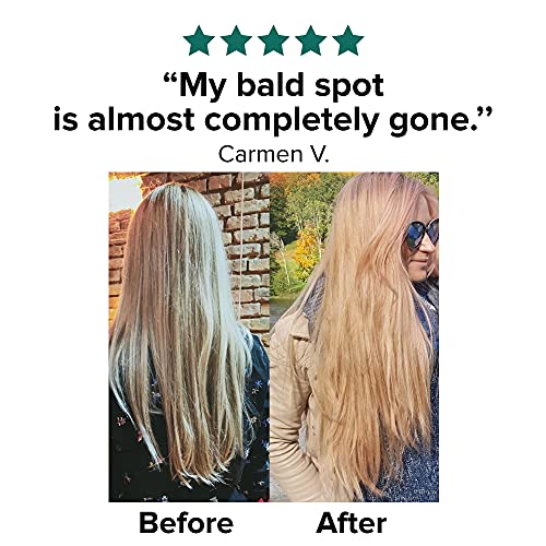 Moerie Mineral Conditioner – For Longer, Thicker, Fuller Hair - Vegan Hair Products – Paraben Free Hair Products – All Hair Types – Reverse Hair Loss – 250ml