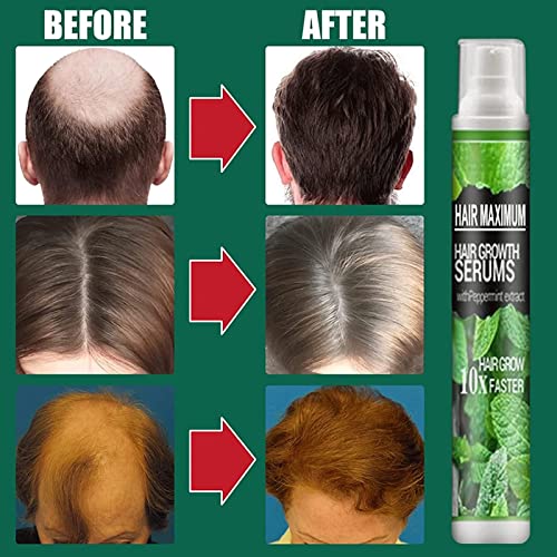 QAZX HairReBirth Herbal Spray, Natural Herbal Hair Growth Essence Spray, HerbalRevive Hair-Growth Essence Spray, Herbal Hair Growth Maximizer Spray for Men and Women Anti Hair Loss Fast Grow (3PCS)