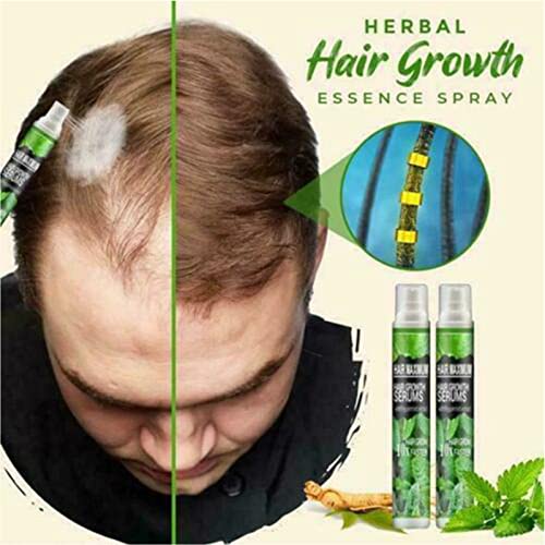 QAZX HairReBirth Herbal Spray, Natural Herbal Hair Growth Essence Spray, HerbalRevive Hair-Growth Essence Spray, Herbal Hair Growth Maximizer Spray for Men and Women Anti Hair Loss Fast Grow (3PCS)