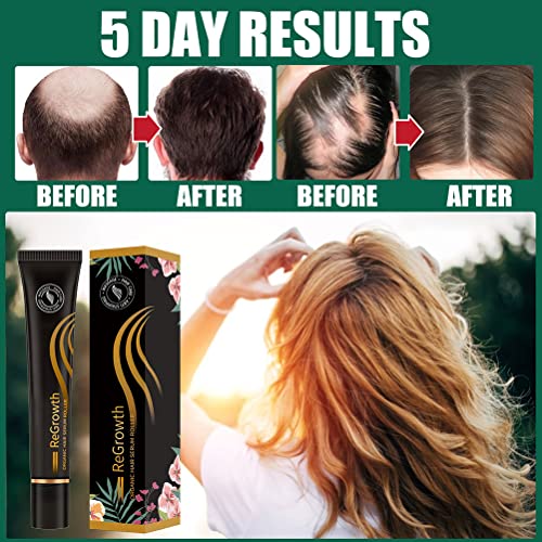 Regrowth Organic Hair Serum Roller, Triple Roll-On Massager Hair Growth Essence, Biotin Hair Growth Serum, ​Anti Lose Hair Care ​for Men and Women of All Hair Types, 20