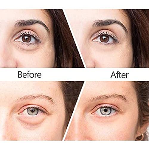 WYBF Cayman Wrinkle Repair Eye Serum,Anti-Wrinkle and Firming Eye Cream For Wrinkles, Fine Lines, Dark Circles, Puffiness & Bags, 20g (1pcs)